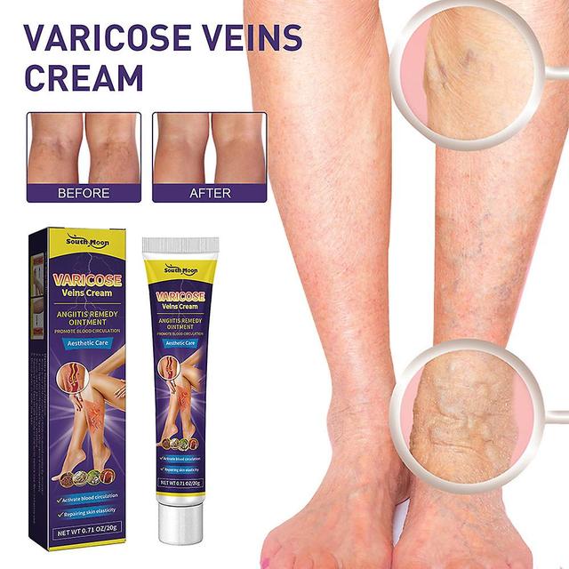 1/2pcs Intravenous Massage Gel,earthworm Leg Vein Blue Veins Protruding Varicose Paste on Productcaster.