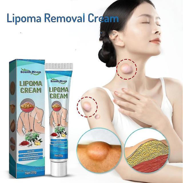 New Lipoma Removal Cream Lipoma Treat Skin Swelling Delipidation Cream -GSL on Productcaster.