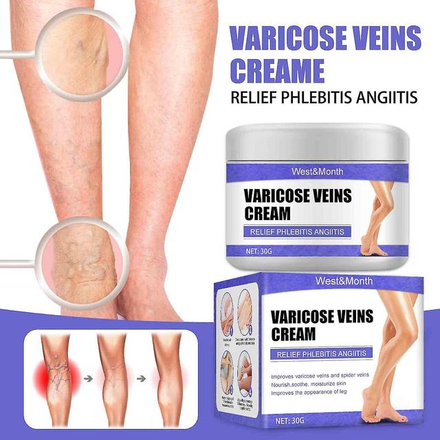 Varicose Vein Repair Cream Veins Eliminated And Spider Improve Circulation Relieve Pain Itching Of Legs on Productcaster.