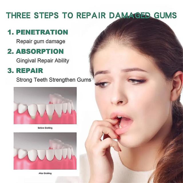 Gum Therapy Gel, Gum Regrowth For Receding Gums, Gum Repair Regrowth on Productcaster.