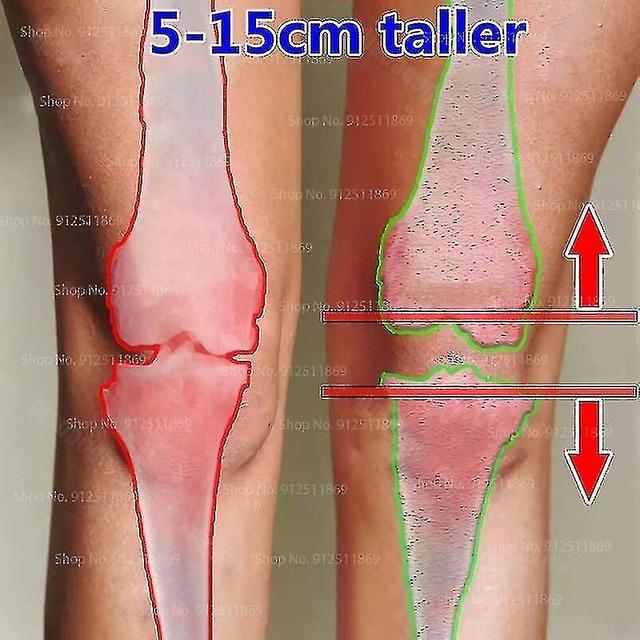 Natura Height Growth Promot Bone Growth Height Increasing Oil Second Increase In Heigh Grow Essential Oil Body Height 5-15cm on Productcaster.