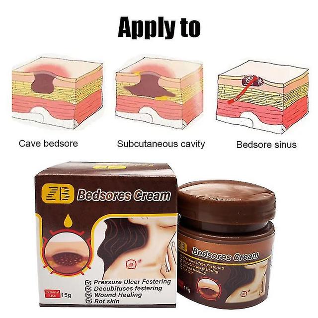 Unitoney Herbal Removal Rot Myogenic Cream Bedsores Paste Treat Pressure Soresdecubitusespressure Ulcer Festering Wound Healing with box on Productcaster.