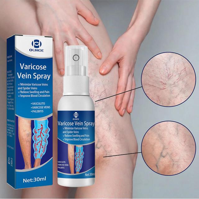 Relieve Vein Care Varicose Blood Vessel Bulging Pain Vein Massage Care Spray on Productcaster.