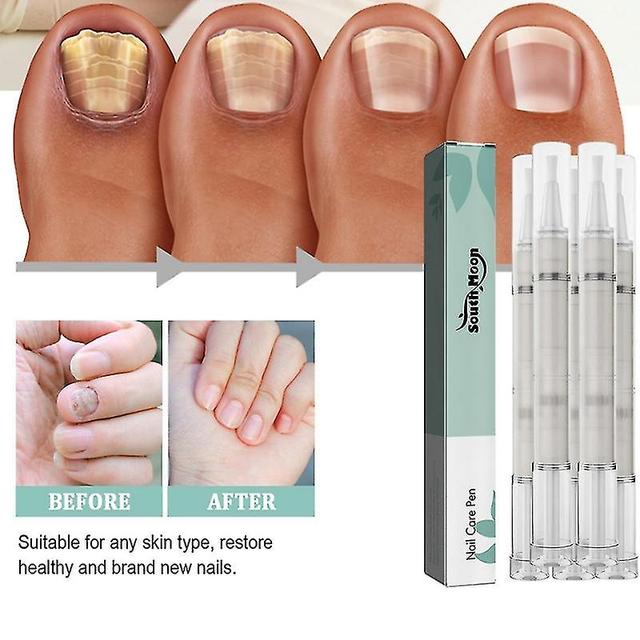 5X HealthroutineNail Care Pen Fungus Intensif Pour Les Ongles Avec Huile D’arbre À Thé Vera on Productcaster.