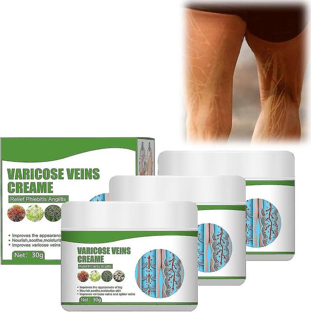 Cremevital Varicose Vein Cream, Varicose Vein Cream For Legs, Eliminate Varicose Veins And Spider Veins, Relieve Pain Xianning 3pcs on Productcaster.