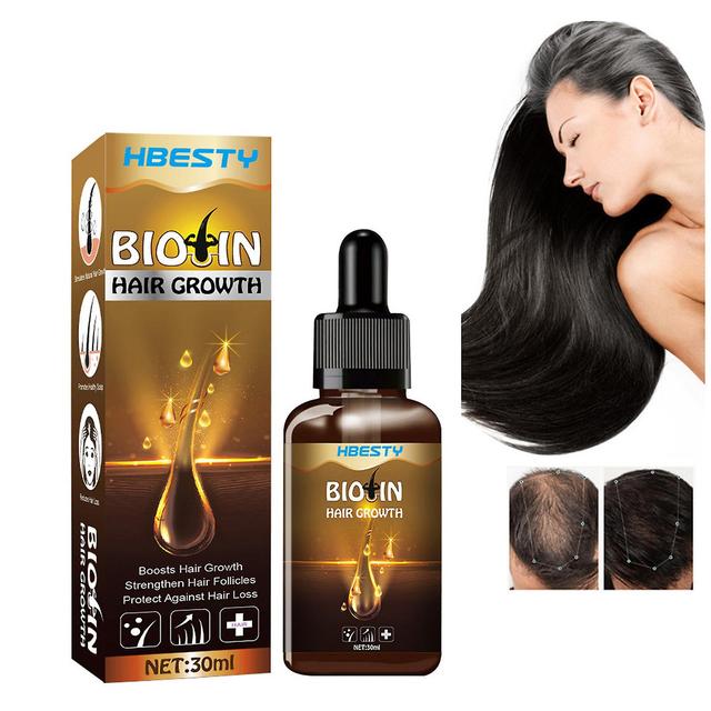 Congjing Haarwuchsmittel Biotin Schnell wachsendes Haar Ätherisches Öl Haarausfall Spray Hautpflege 30ml on Productcaster.