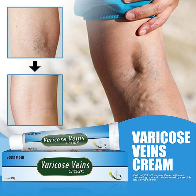 Intravenous Massage Gel,earthworm Leg Vein Blue Veins Protruding Varicose Paste 20g 1PC on Productcaster.