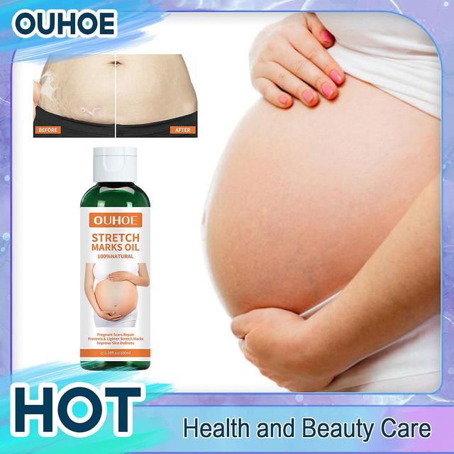 Qian Pregnancy Oil Stretch Marks Remover Peeling Oil for Postpartum Obesity Pregnancy Maternity Surgical Scar Treatment Pregnant Care on Productcaster.