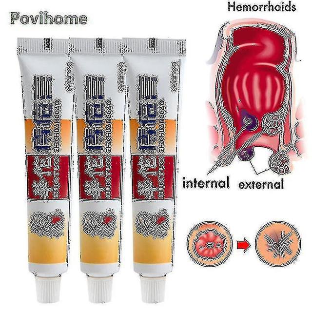 1/3 / 5 sztuk Huatuo Hemoroid Krem Wewnętrzne pale zewnętrzne Chińskie zioła Ointm 3szt bez pudełka on Productcaster.