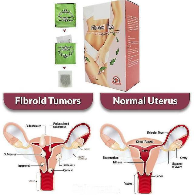 Fibroid Tea For Women | Warm Uterus Detox Bags Natural Female Fertility Tea For Preconception Pregnant on Productcaster.