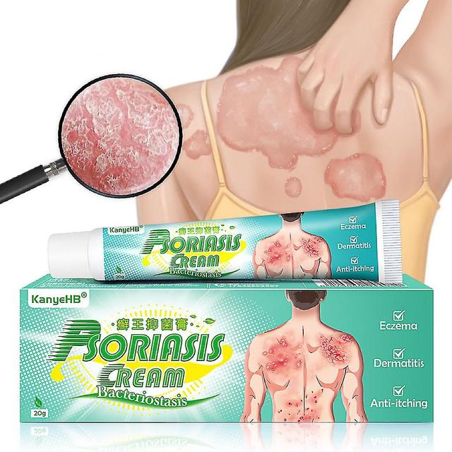 Can Treat Dermatitis Eczema Psoriasis Hemorrhoids And Acne Ointment Chinese Herbal Extracts Skin Ringworm Cream LPY on Productcaster.