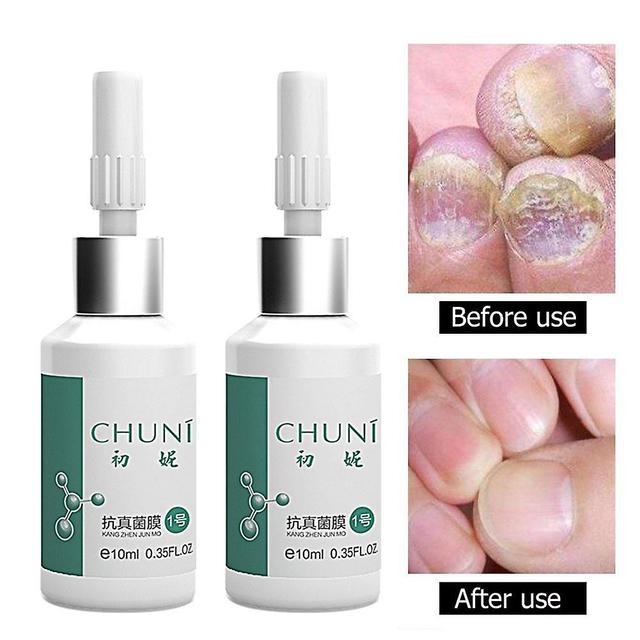 Hardening Portable Glue For The Pauconychia, For The Restoration Of The Nails, For Repair, For External Use, 20ml on Productcaster.