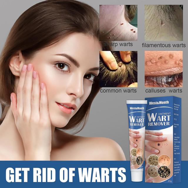 Quyou cream, wart cream, gram wart cream Topi Thuja Cream 20g Helps to Treat Warts on Productcaster.