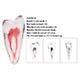 Easyget 12 Size 1:1 Dental Rct Endo Training Teeth Model 3d Curved Root Teeth Model Premolar B-1PC on Productcaster.