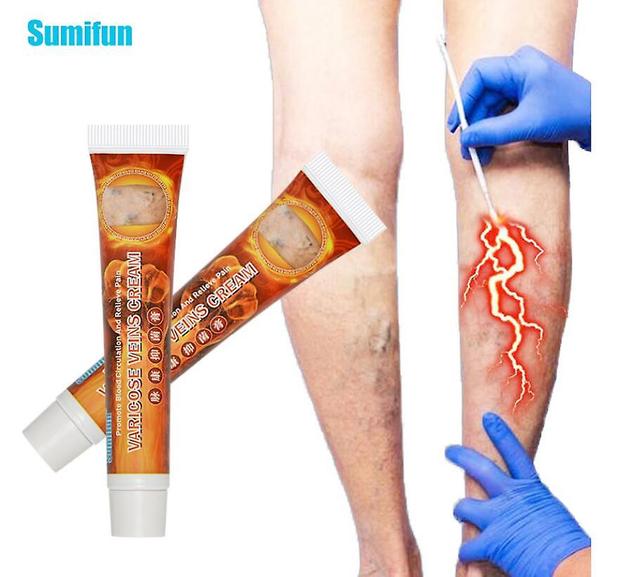 Qian 1/2pcs 20g Varicose Veins Ointmnet Vasculitis Phlebitis Spider Cream Varicosity Angiitis Removal Herbal Medical Plaster 1PCS on Productcaster.