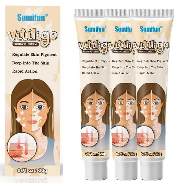 1-5pcs Kräuterextrakt Vitiligo Salbe entfernen Ringelflechte weiße Flecken entfernen Haut Vitiligo Beseitigen Vitiligo Behandlung Creme 3pcs on Productcaster.