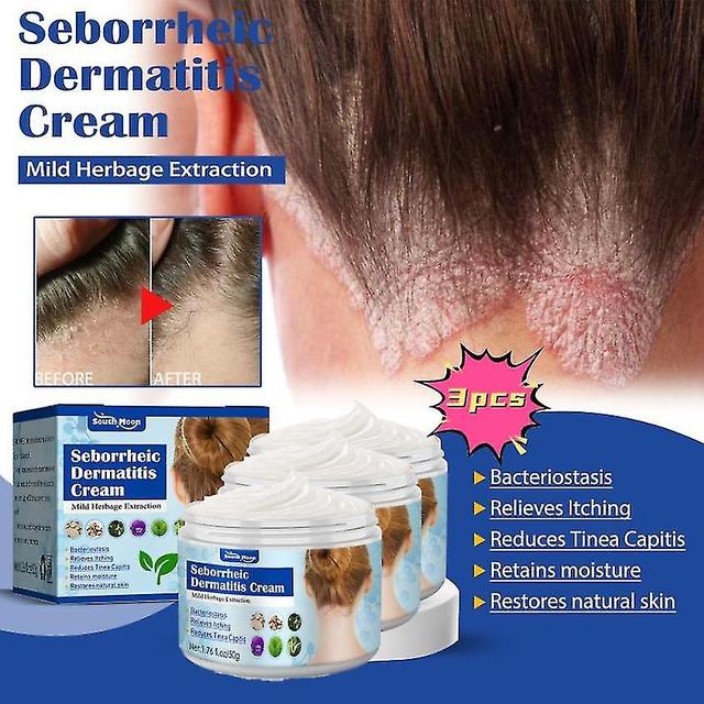 South Moon Seborrheic Skin Cream, Head Acne Itching, Scalp Ringworm, Skin Problem Repairing Skin Cre 3PCS on Productcaster.