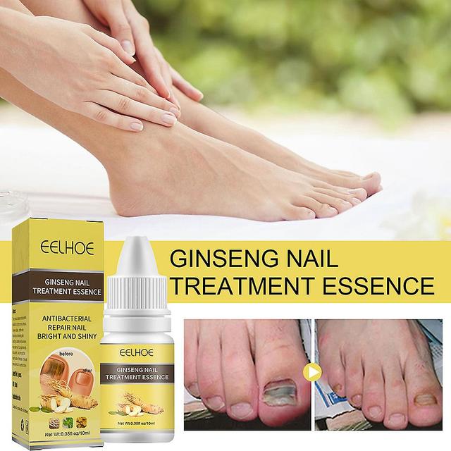 unbrand Ginseng Antibacterial Nail Treatments Essential Oil Nails Fungus Repair 10ml Default on Productcaster.