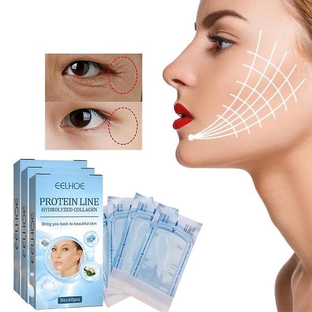 60 Pcs Fil De Protéine Pas D’aiguille Ligne De Protéine Or Collagène Résorbable Pour Le Lifting Du Visage Anti-Âge Hyaluronique Resserrant Outils P... on Productcaster.