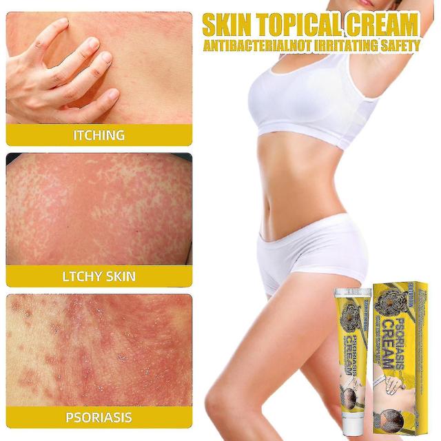 Skin Repair Cream Moss Versicolor Sweat Spot Topische Applicatie Zalf on Productcaster.