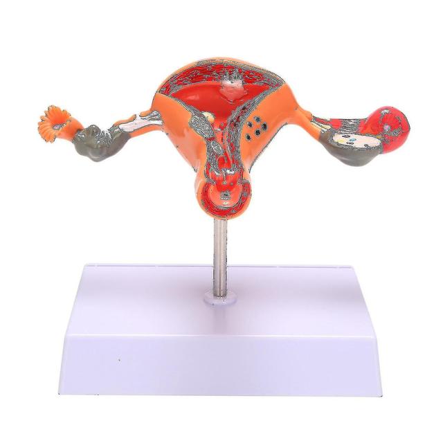 Uterus Ovary Anato Fe Reproductive on Productcaster.