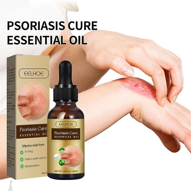 Psoriasis Repair Essential Oil on Productcaster.