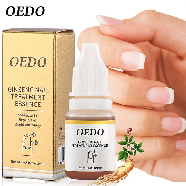 Nail Essence Liquid Nail And Foot Whitening Toe Nail Fungu Verwijdering Herbal Nail Treatments Etherische Olie 10ml Meerkleurige on Productcaster.