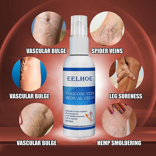 30ML Anti-Varicose Soothing Spray Verbeteren Bloedcirculatie Massage Vloeistof on Productcaster.