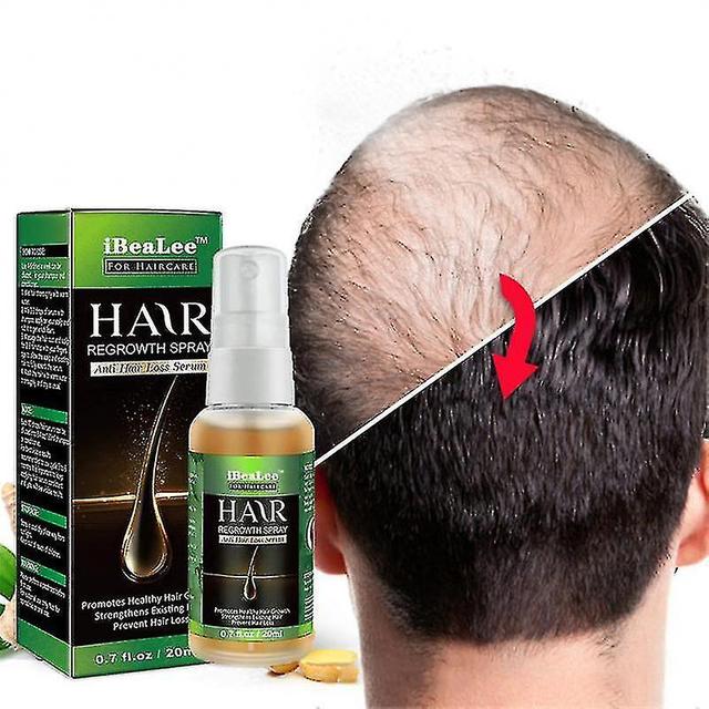 Olio essenziale per la crescita dei capelli 20ml Ginger King Authentic 100% Hair Growth Liquid Plant on Productcaster.