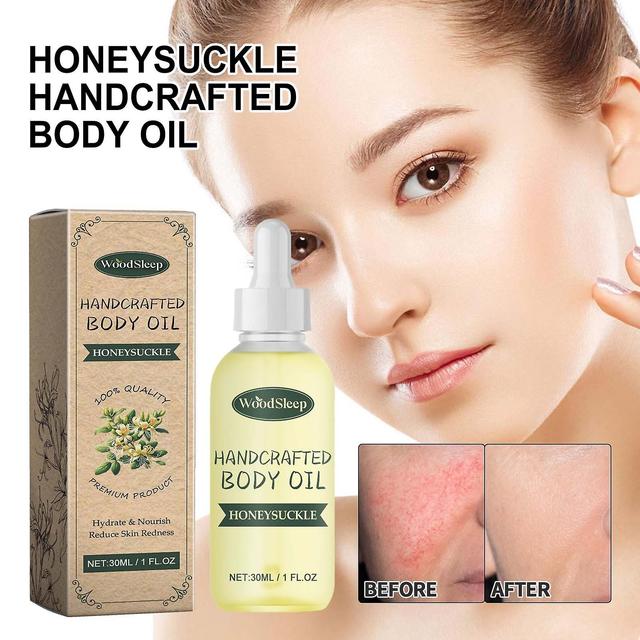 Flye Honeysuckle Inflammatory Regulatory Essential Oil 30ml A Natural Solution For Wellness And Healing FLY1071 Multicolor on Productcaster.