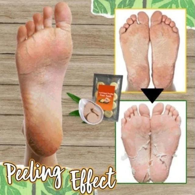 10Pcs Ginger Foot Soak Effervescent Tablets DIY Foot Spa Peeling Effect Improve Sleeping Foot Care Treatment on Productcaster.