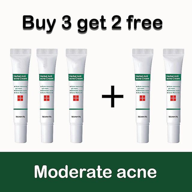 Anti-acne Cream To Eliminate Acne And Acne Marks, Plant Extracts, Efficient, Anti-inflammatory, Skin Repair, Foil Control Buy 3 get 2 free on Productcaster.