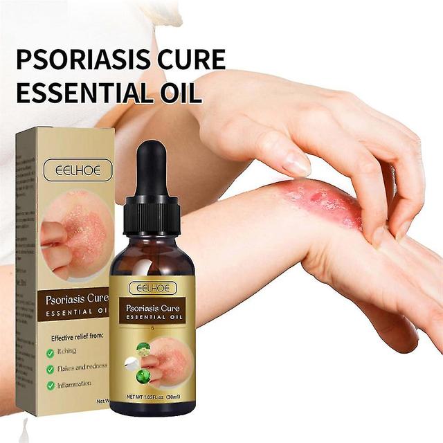 Yalo New Psoriasis Essential Oil Relieves Itching, Burning, Redness, Powerful Mild Herbal, 100% Natural Ingredients on Productcaster.