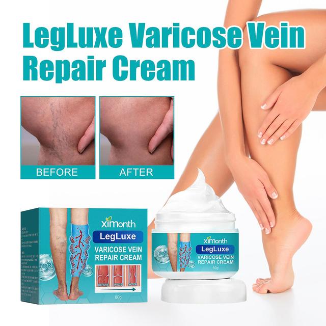 Ximonth Vein Care Cream repairs raised blood vessels in legs and relieves leg pain and swelling massage care cream 60g on Productcaster.