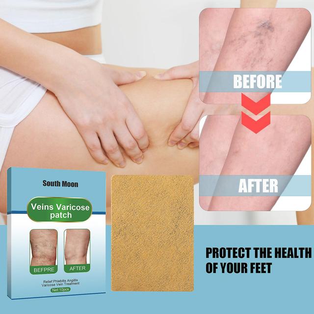 South Moon Leg Vein Care Patch, Muscle Rejuvenating and Revitalizing Patch, Muscle and Bone Leg Massage Care Patch Massage Oil1PCS) 1PCS on Productcaster.