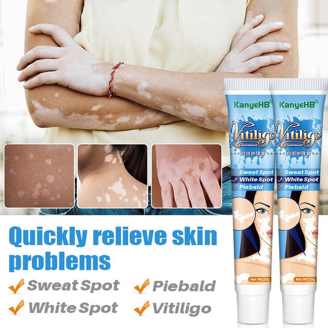 Face Vitiligo salve med planteekstrakter, eliminerer hvide pletter af ringorm, hudserum, reparation af pigmenterne af leukoplasi sygdomme, 20g 30F on Productcaster.