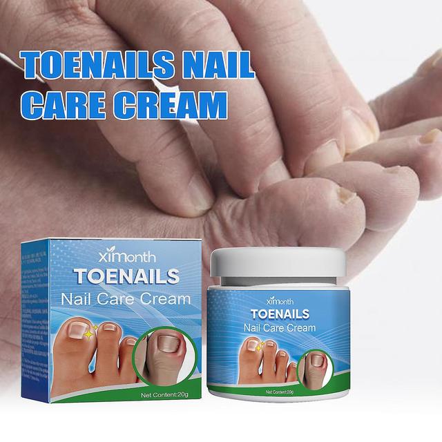 Ximonth Nail Care Cream Repairs Onychomycosis, Ingrown Toenails, Soft Nails, Thickens Nails, Relieves Swelling and Pain Care BF on Productcaster.