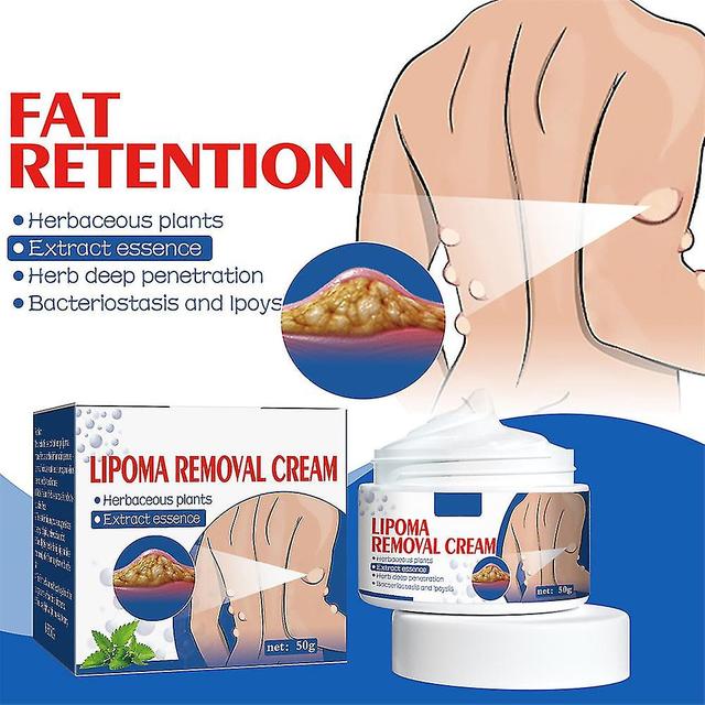 Lipoma Removal Cream Lipolysis Fat Lump Relief Plaster Skin Swelling Fat Elimination Cream Free Shipping 50g Health Care on Productcaster.