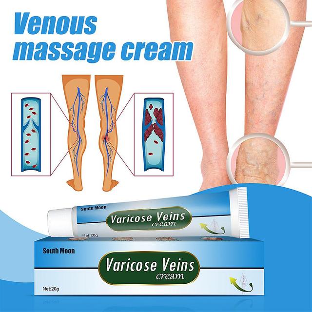 Intravenous Massage Gel,earthworm Leg Vein Blue Veins Protruding Varicose Paste 20g 2PCS on Productcaster.