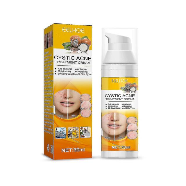 Mysept Acne Treat Cream for Cystic, Hormonal, and Severe Acne on Productcaster.