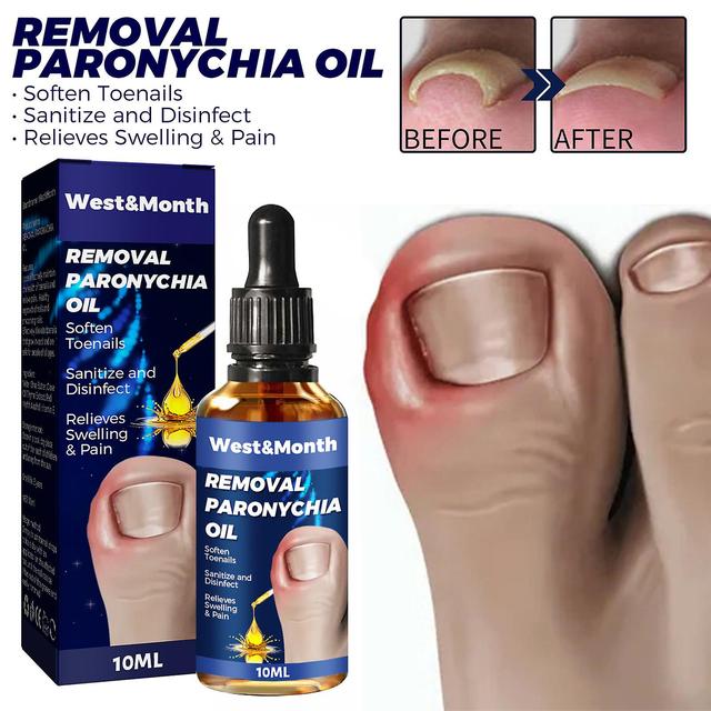 ShuFu Inlaid nail groove relief oil repair inlaid toenail onychomycosis nail groove soft nail meat removal care oil 10ml 1pcs on Productcaster.