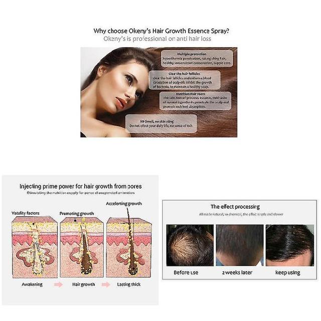 Ginger Hair Growth Essence Spray 20ml Hair Grow Restoration Oil Prevent Baldness on Productcaster.