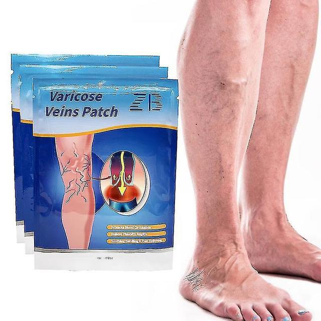 christina show 12pcs Varizes Gesso Medicina Tradicional Vasculite Phlebitis Creme Perna Medical Patch Angi on Productcaster.