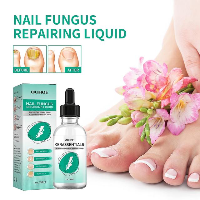 NATUREASY Extra Sterkte Teennagel Schimmel Behandeling Voor Teennagel Of Vingernagel, Nagel Reparatie Oplossing, Nagelvernieuwing Vloeistof Voor Be... on Productcaster.