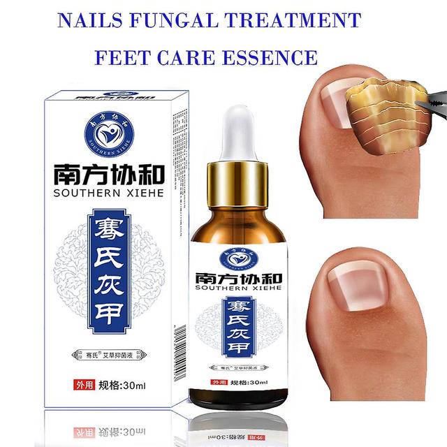 Antifungal Treatment Of Nails, Feet Care, Gasoline, Repair Of Nails, Toes, Anti-infection Gel, Paronychia on Productcaster.