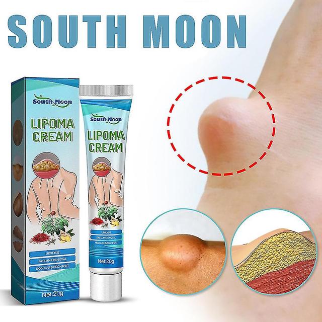 1/2 sztuk Fat Balm Body Fat Lump Guz Podskórne Lumps Relief Loosen Disperse Knots Natural Cream 1pc on Productcaster.