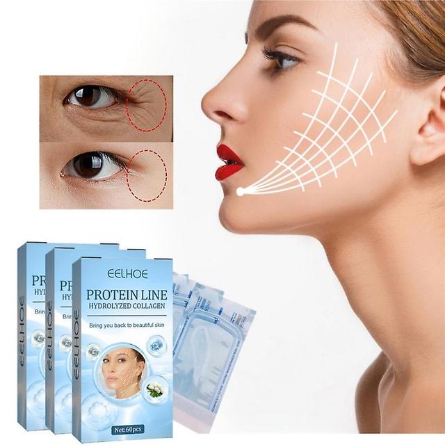 180pcs Protein Thread No Needle Gold Protein Line Absorbable Collagen For Facial Lift Anti Aging Hyaluronic Tightening Skin Tools on Productcaster.