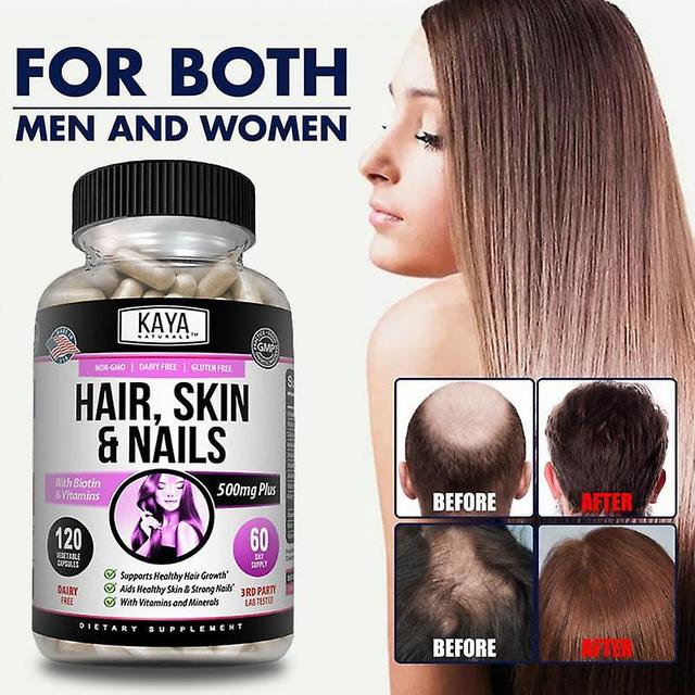 Vorallme Aids In Hair Growth And Also Increases Hair Strength, Shine And Thickness. Promotes Healthy Nails And Skin 30 capsules A bottle on Productcaster.