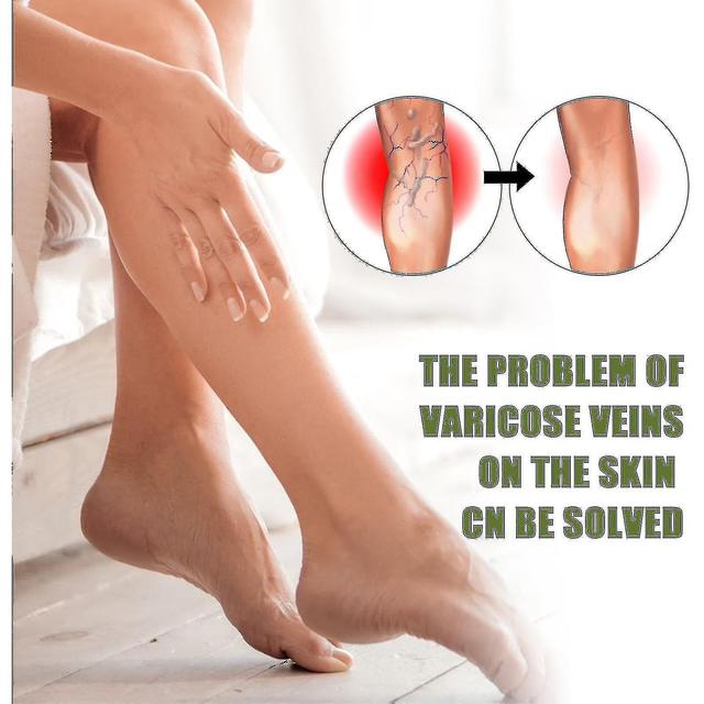 Qian Vein Massa Leg uso esterno Vein Bue per alleviare il dolore e le varicose rosse on Productcaster.