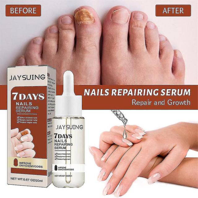 Gfouk 7 Days Nail Growth And Strengthening Serum, Nail Growth And Strength Serum on Productcaster.